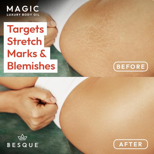 Magic Body Oil 3.38 Fl Oz – Hydrating, Firming & Nourishing After-Shower Body Oil