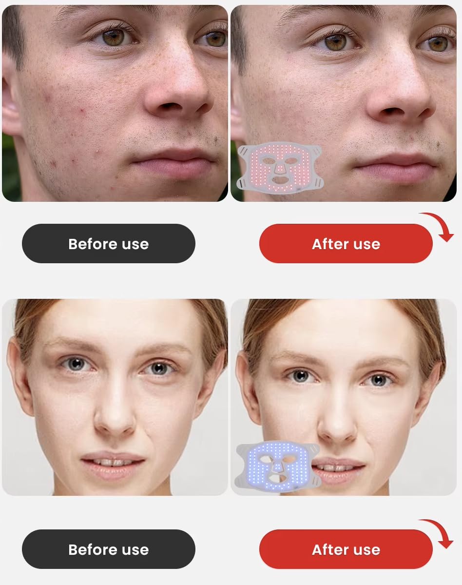 LED Light Therapy Face & Neck Mask for Anti-Aging & Skin Firming