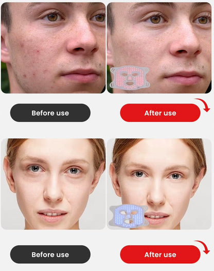 LED Light Therapy Face & Neck Mask for Anti-Aging & Skin Firming