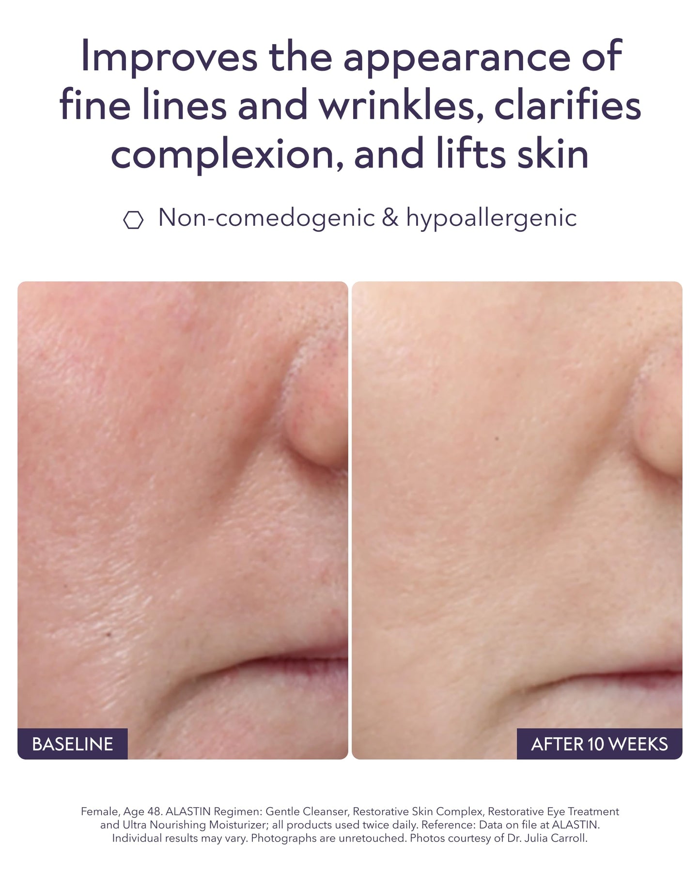 Advanced Skincare Serum Bundle with Vitamin C, Restorative Complex & Hyaluronic Acid