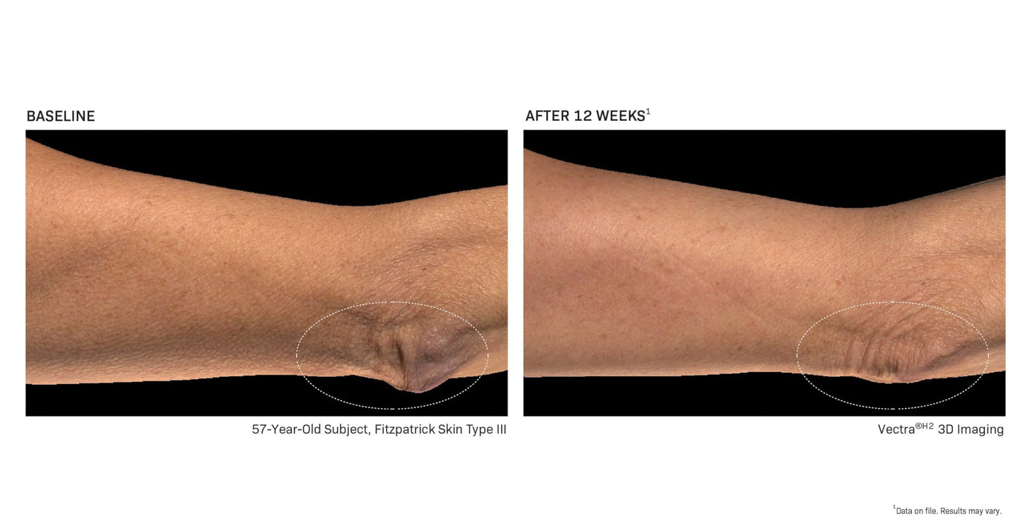 BodiContour Contouring Body Lotion with iFirm® Technology for Firming & Lifting