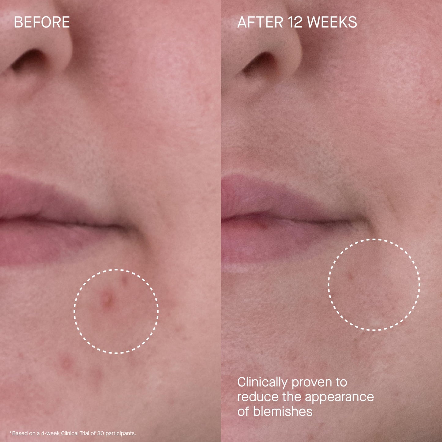 The Rich Cream Luxury Face Moisturizer for Hydration & Wrinkle Reduction