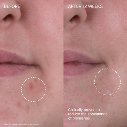 The Rich Cream Luxury Face Moisturizer for Hydration & Wrinkle Reduction